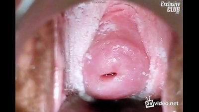 ලස්සන කාන්තාවකගේ නාරිවේද වෛද්ය පරීක්ෂණය